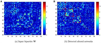 Latent and Abnormal Functional Connectivity Circuits in Autism Spectrum Disorder